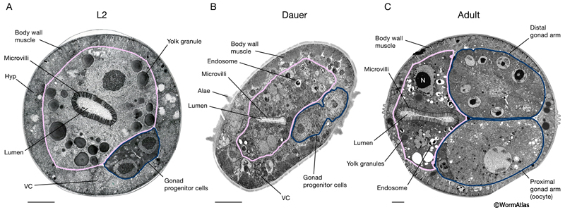 DIntFIG 2A: Midbody intestinal cells in an L2 larva, dauer larva and adult hermaphrodite.